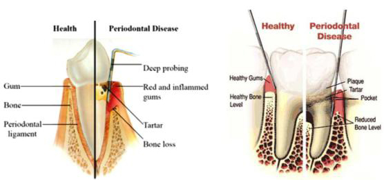 periodontics service